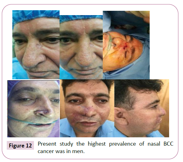 aesthetic-reconstructive-surgery-prevalence-nasal