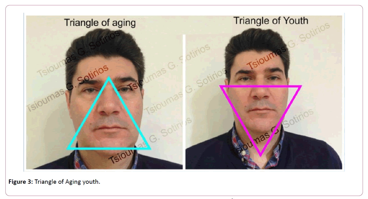 aesthetic-reconstructive-surgery-Aging-youth