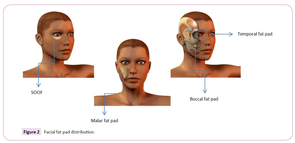 aesthetic-reconstructive-surgery-Facial-fat