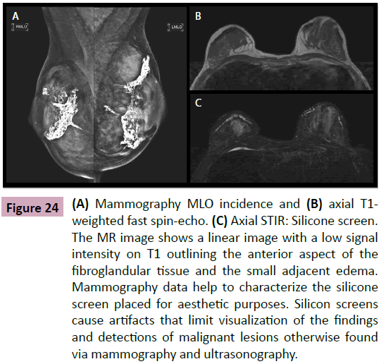 aesthetic-reconstructive-surgery-Mammography-MLO-incidence
