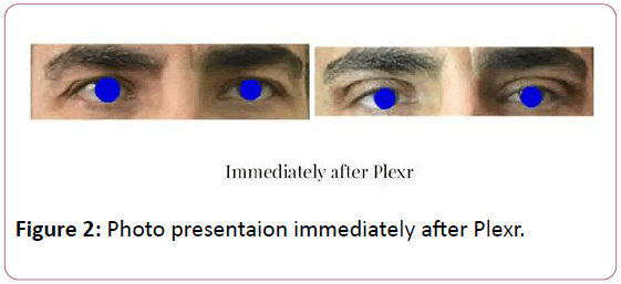 aesthetic-reconstructive-surgery-after-Plexr
