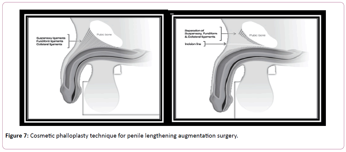 aesthetic-reconstructive-surgery-augmentation-surgery