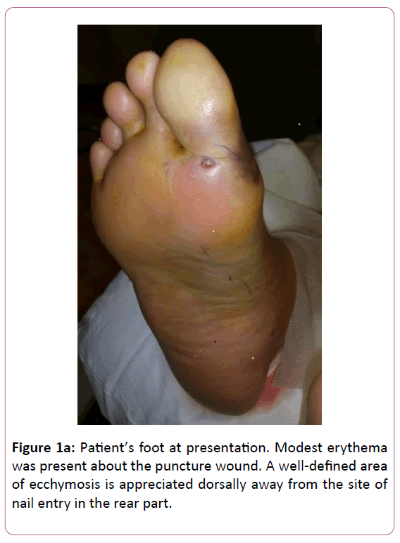 aesthetic-reconstructive-surgery-foot-presentation