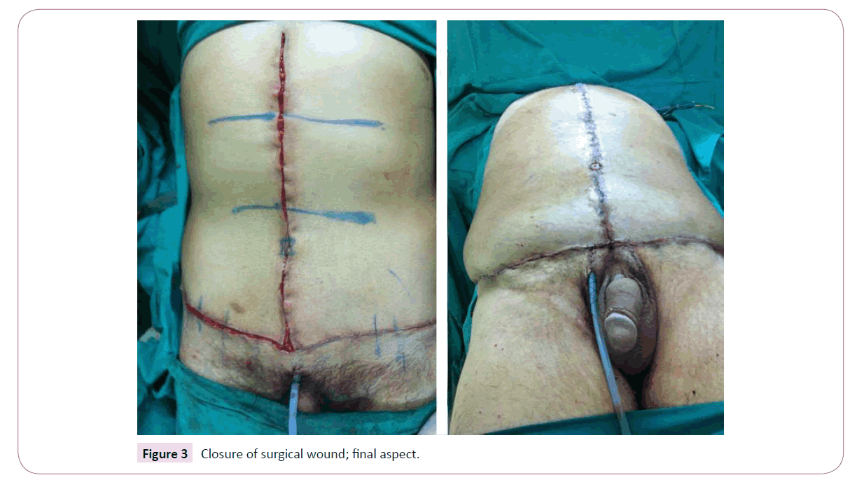 aesthetic-reconstructive-surgery-surgical-wound
